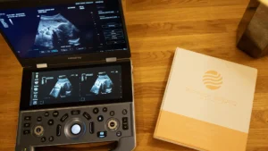 Sonographer performing mobile ultrasound imaging at a patient's home