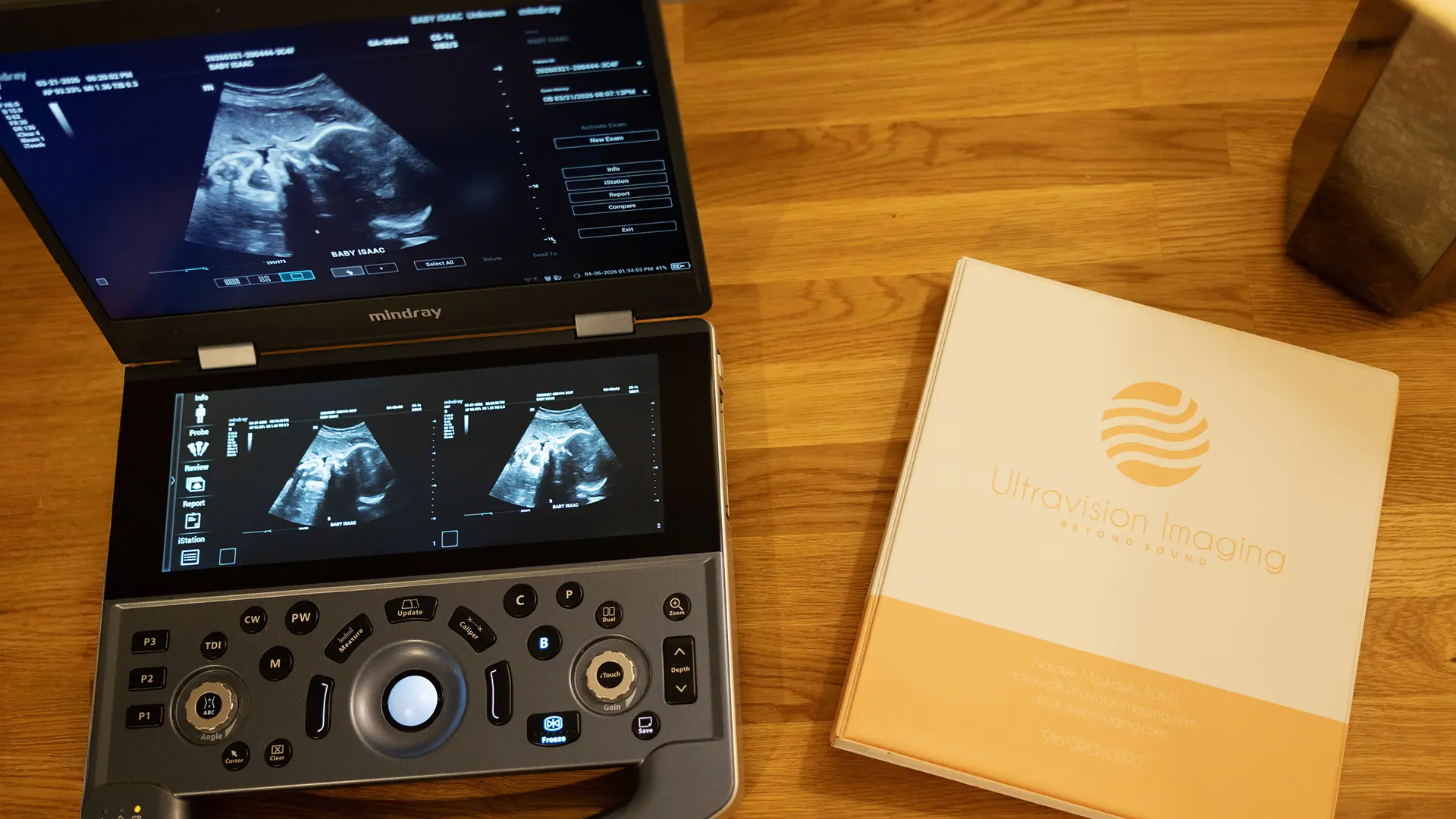 Sonographer performing mobile ultrasound imaging at a patient's home